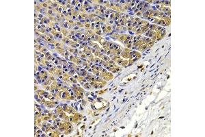 Immunohistochemistry of paraffin-embedded rat stomach using FSCN1 antibody. (Fascin 抗体  (AA 394-493))