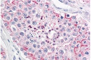 Human Testis: Formalin-Fixed, Paraffin-Embedded (FFPE) (ERMP1 抗体  (Internal Region))