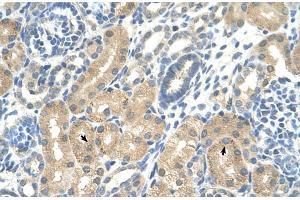 Rabbit Anti-KHK Antibody  Paraffin Embedded Tissue: Human Kidney Cellular Data: Epithelial cells of renal tubule Antibody Concentration: 4. (Ketohexokinase 抗体  (C-Term))
