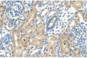Rabbit Anti-KHK Antibody  Paraffin Embedded Tissue: Human Kidney Cellular Data: Epithelial cells of renal tubule Antibody Concentration: 4. (Ketohexokinase 抗体  (C-Term))