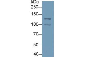Detection of HIF1a in Hela cell lysate using Monoclonal Antibody to Hypoxia Inducible Factor 1 Alpha (HIF1a) (HIF1A 抗体  (AA 218-506))