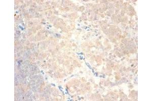 Immunohistochemistry of paraffin-embedded human lymph node tissue using ABIN7145987 at dilution of 1:100 (CCL24 抗体  (AA 27-119))
