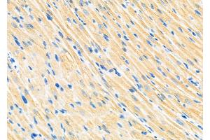 ABIN6264231 and ABIN6273298 at 1/100 staining Rat heart tissue by IHC-P.