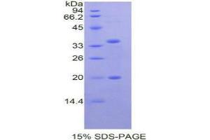 SDS-PAGE analysis of Human SPINK5 Protein. (SPINK5 蛋白)