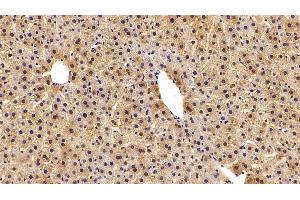 Detection of GSTa3 in Rat Liver Tissue using Polyclonal Antibody to Glutathione S Transferase Alpha 3 (GSTa3) (GSTA3 抗体  (AA 1-222))