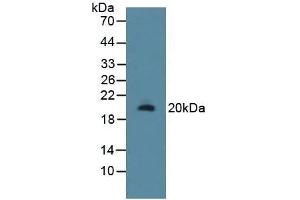 Detection of RSPO1 in Rat Uterus Tissue using Polyclonal Antibody to R-Spondin 1 (RSPO1) (RSPO1 抗体  (AA 136-262))