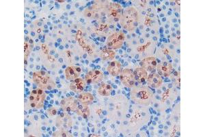 Used in DAB staining on fromalin fixed paraffin- embedded kidney tissue (GSTA1 抗体  (AA 2-222))