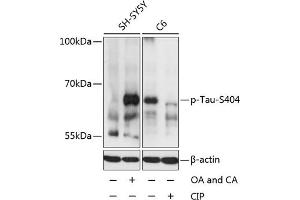 Western blot analysis of extracts of SH-SY5Y and C6 cells, using Phospho-Tau-S404 antibody (ABIN3019703, ABIN3019704, ABIN3019705 and ABIN1681813) at 1:2000 dilution. (MAPT 抗体  (pSer404))