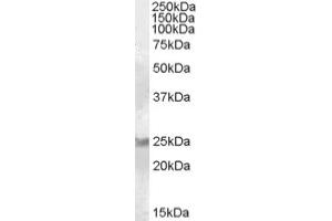 Image no. 1 for anti-RAB8A, Member RAS Oncogene Family (RAB8A) (C-Term) antibody (ABIN374945) (RAB8A 抗体  (C-Term))