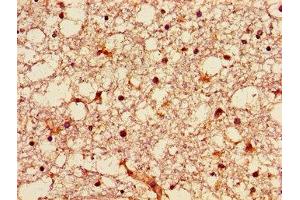 Immunohistochemistry of paraffin-embedded human brain tissue using ABIN7149942 at dilution of 1:100 (GNPAT 抗体  (AA 589-680))