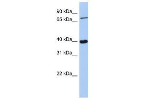 WB Suggested Anti-PRDM4 Antibody Titration:  0. (PRDM4 抗体  (C-Term))