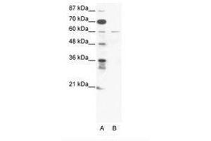 Image no. 1 for anti-Zinc Finger Protein 92 (ZNF92) (C-Term) antibody (ABIN203188) (ZNF92 抗体  (C-Term))
