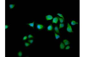 Immunofluorescence staining of Hela cells with ABIN7167153 at 1:66, counter-stained with DAPI. (RASAL2 抗体  (AA 749-835))