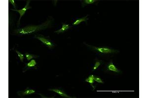 Immunofluorescence of purified MaxPab antibody to GOLGA2 on HeLa cell. (Golgin A2 (GOLGA2) (AA 1-990) 抗体)