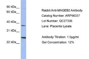 WB Suggested Anti-MAGEB2  Antibody Titration: 0. (MAGEB2 抗体  (N-Term))