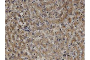 Image no. 1 for anti-Peroxisomal Biogenesis Factor 11 beta (PEX11B) (AA 1-99) antibody (ABIN599479) (PEX11B 抗体  (AA 1-99))