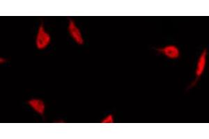 ABIN6267495 staining Hela by IF/ICC. (PPARG 抗体  (pSer112))