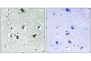 Immunohistochemistry analysis of paraffin-embedded human brain, using JAK2 (Phospho-Tyr931) Antibody. (JAK2 抗体  (pTyr931))