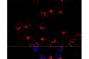 Confocal immunofluorescence analysis of Hela cells using USO1 Polyclonal Antibody at dilution of 1:200. (USO1 抗体)