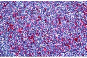 Human Tonsil: Formalin-Fixed, Paraffin-Embedded (FFPE) (Gelsolin 抗体  (AA 673-783))