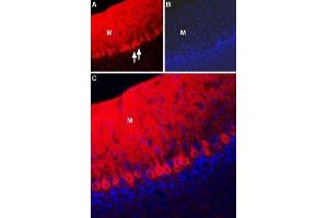 Immunohistochemistry (IHC) image for anti-Solute Carrier Family 8 (Sodium/calcium Exchanger), Member 2 (SLC8A2) (AA 486-499) antibody (ABIN7043755)