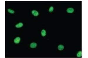 Immunostaining analysis in HeLa cells. (SAE1 抗体)