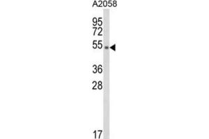 Western Blotting (WB) image for anti-Disabled Homolog 2, Mitogen-Responsive phosphoprotein (Drosophila) (DAB2) antibody (ABIN3003993) (DAB2 抗体)