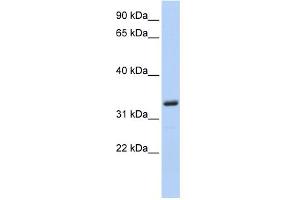WB Suggested Anti-MS4A4A Antibody Titration: 0. (MS4A4A 抗体  (N-Term))