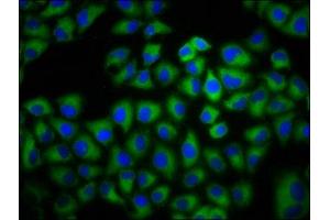 Immunofluorescence staining of Hela cells with ABIN7143334 at 1:133, counter-stained with DAPI. (ADCY6 抗体  (AA 9-118))