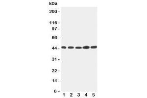 Western blot testing of Hepsin antibody and Lane 1:  293T (Hepsin 抗体  (C-Term))