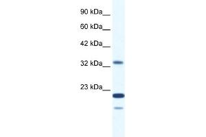 WB Suggested Anti-ZNF688 Antibody Titration:  2. (ZNF688 抗体  (Middle Region))