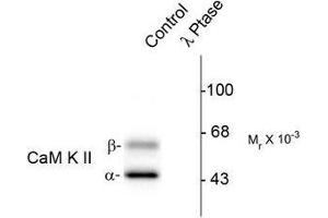 Image no. 1 for anti-Calcium/calmodulin-Dependent Protein Kinase II alpha (CAMK2A) (pThr286) antibody (ABIN372594) (CAMK2A 抗体  (pThr286))