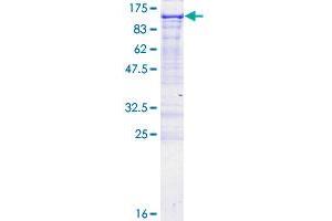 EPB41L1 Protein (AA 1-779) (GST tag)