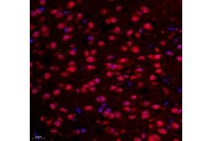 Immunofluorescence of paraffin embedded mouse prefrontal lobe using NCBP2 (ABIN7074870) at dilution of 1: 650 (400x lens) (NCBP2 抗体)