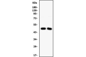 Western blot analysis of SFRP4 using anti-SFRP4 antibody (ABIN3044543). (SFRP4 抗体  (AA 22-303))