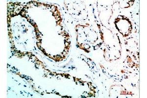 Immunohistochemical analysis of paraffin-embedded human-testis, antibody was diluted at 1:200 (IL-31 抗体  (AA 21-70))