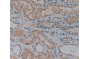 Used in DAB staining on fromalin fixed paraffin- embedded Kidney tissue (DPP7 抗体  (AA 28-486))