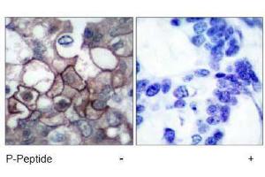 Image no. 2 for anti-Epidermal Growth Factor Receptor (EGFR) (pTyr1197) antibody (ABIN196974) (EGFR 抗体  (pTyr1197))