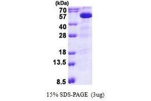 Figure annotation denotes ug of protein loaded and % gel used. (PIP4K2B 蛋白)