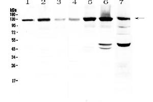 Western blot analysis of Eph receptor A2  using anti-Eph receptor A2  antibody . (EPH Receptor A2 抗体  (AA 851-970))