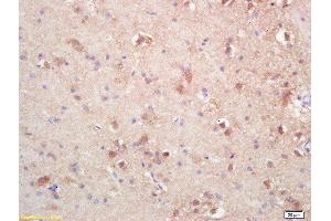 Formalin-fixed and paraffin embedded rat brain labeled with Rabbit Anti SOAT2/ACAT2 Polyclonal Antibody, Unconjugated  at 1:200 followed by conjugation to the secondary antibody and DAB staining (SOAT2 抗体  (AA 331-430))