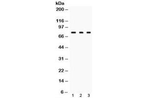 Western blot testing of TGM2 antibody and Lane 1:  rat liver, 2. (Transglutaminase 2 抗体)