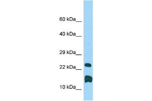 WB Suggested Anti-Lmo1 Antibody Titration: 1. (LMO1 抗体  (C-Term))