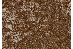 ABIN6262736 and ABIN6277134 at 1/100 staining Mouse spleen tissue by IHC-P. (KBTBD3 抗体  (C-Term))