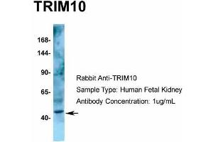 Host: Rabbit  Target Name: TRIM10  Sample Tissue: Human Fetal Kidney  Antibody Dilution: 1. (TRIM10 抗体  (C-Term))