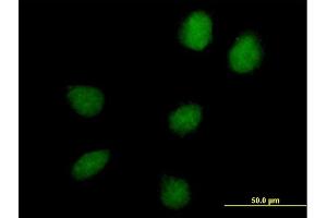 Immunofluorescence of purified MaxPab antibody to C17orf66 on HeLa cell. (C17orf66 抗体  (AA 1-219))