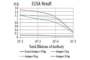 Black line: Control Antigen (100 ng),Purple line: Antigen (10 ng), Blue line: Antigen (50 ng), Red line:Antigen (100 ng)