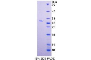 SDS-PAGE (SDS) image for DNA Polymerase alpha (POLA1) (AA 1240-1462) protein (His tag) (ABIN6238649)