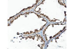 IHC analysis of UBA6 using anti-UBA6 antibody (ABIN7602559).