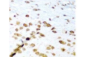 Immunohistochemistry (Paraffin-embedded Sections) (IHC (p)) image for anti-ELAV-Like 3 (ELAVL3) antibody (ABIN7261946)